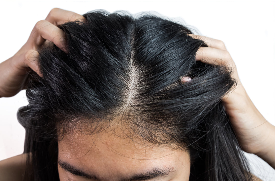How the Sun Damages Hair & How You Can Protect It