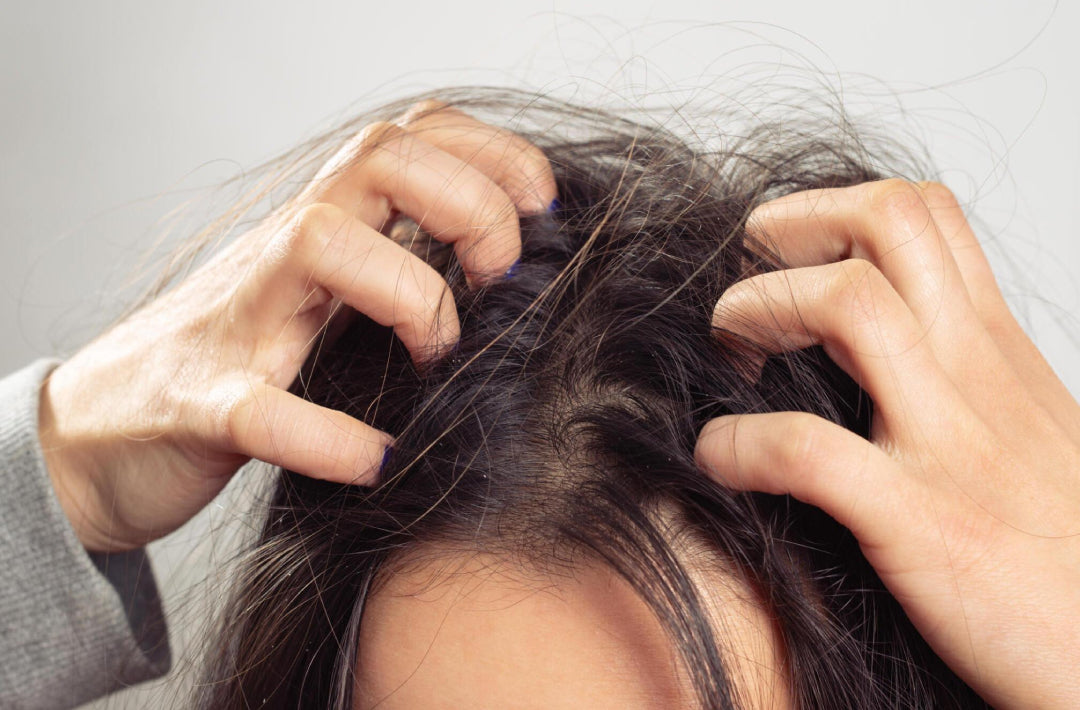 How to deal with common summer scalp issues